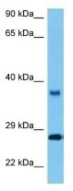 OR5B21 Rabbit anti-Mouse, Polyclonal, Novus Biologicals 100 &mu;g; Unconjugated:Antibodies,